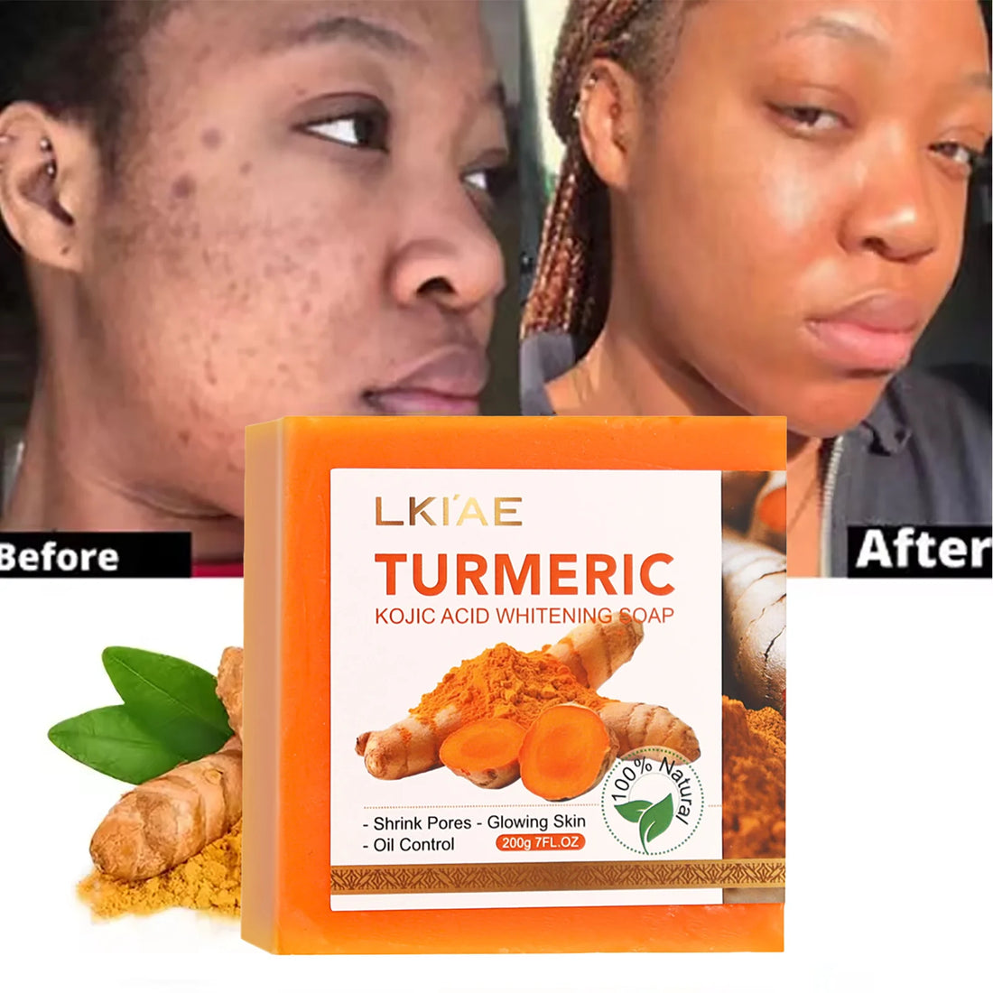 Kojic Acid & Turmeric Herbal Anti-Acne Soap